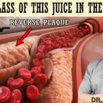 1 Glass Of This Juice In The Morning…reverse Clogged Arteries & Lower High Blood Pressure